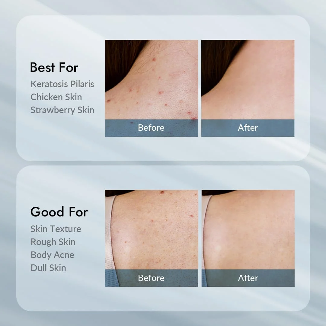 Relax Day AHA Exfoliation Body Lotion (300g) - Image 7