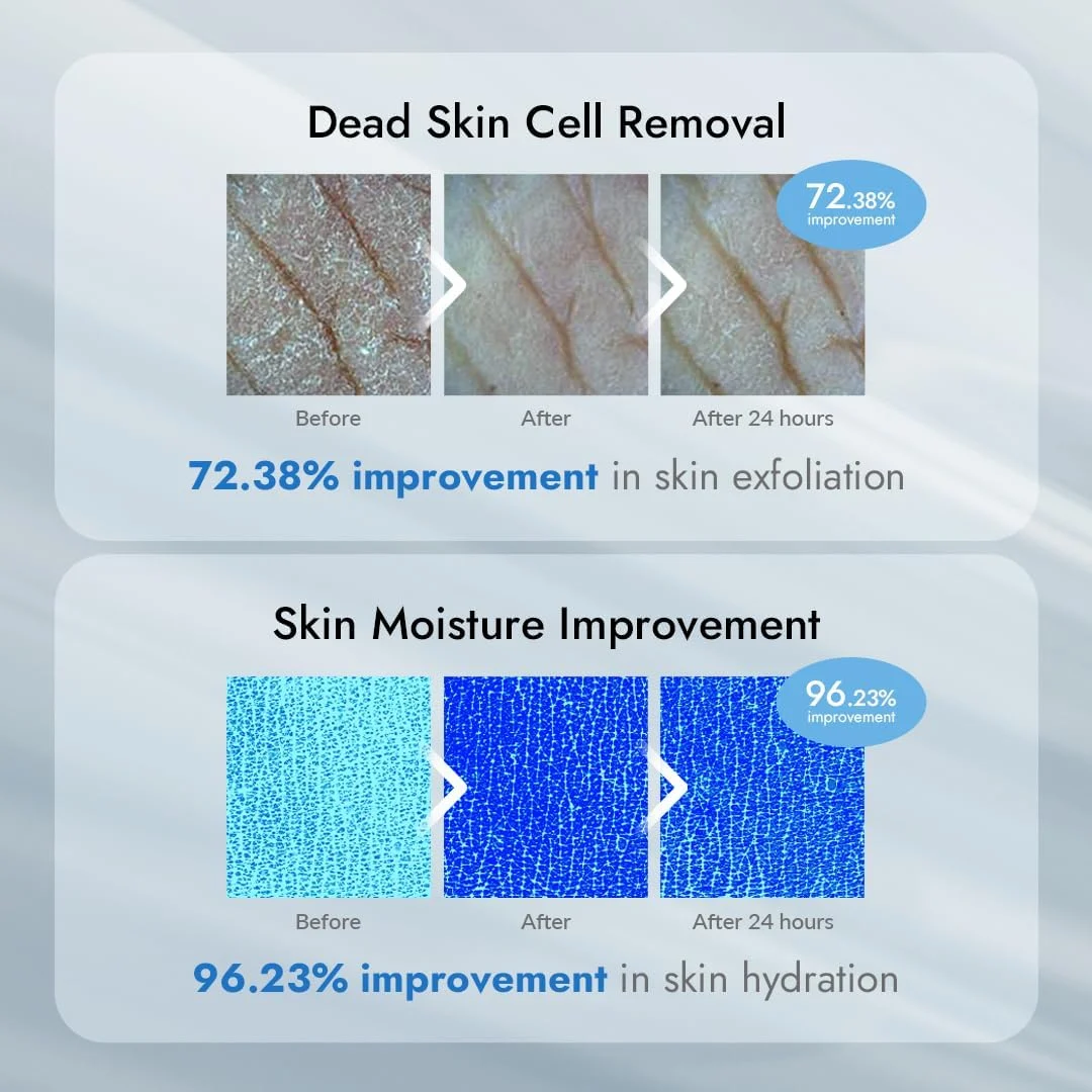 Relax Day AHA Exfoliation Body Lotion (300g) - Image 5